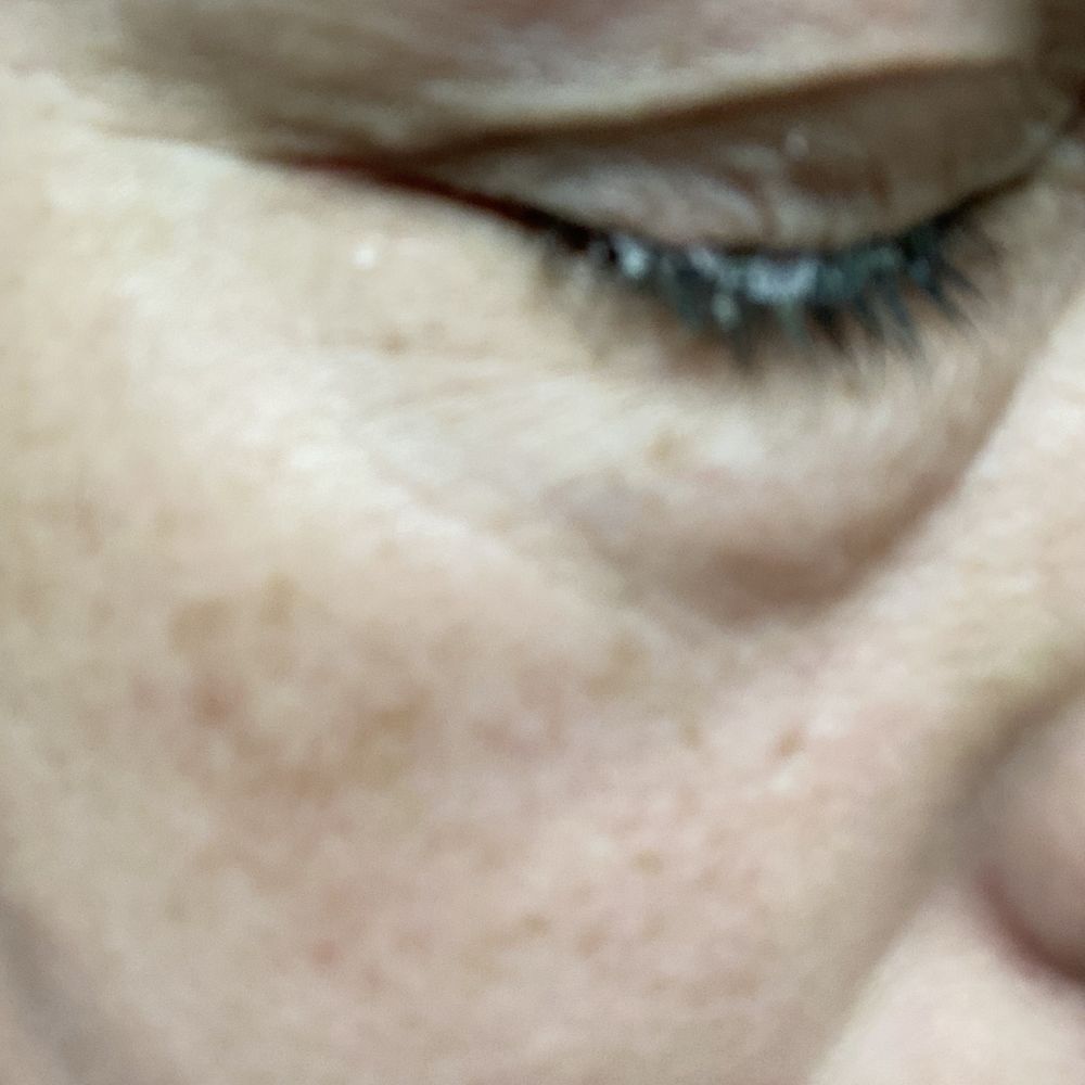 Ali Cat's Spa - Most burning from solution 3 hours after service - Skin Care Near Me - Mesa, Arizona Ali Cat's Spa - Most burning from solution 3 hours after service - Skin Care Near Me - Mesa, Arizona
