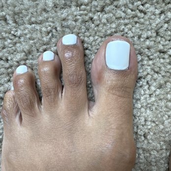 Anthony Vince' Nail Spa - Done by salon damage on big toe right corner - Nail Salons Near Me - Upper Arlington, Ohio Anthony Vince' Nail Spa - Done by salon damage on big toe right corner - Nail Salons Near Me - Upper Arlington, Ohio