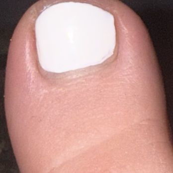 Nail Box - Polish way too far from cuticle line, nail cut way too short - Nail Salons Near Me - Edmond, Oklahoma Nail Box - Polish way too far from cuticle line, nail cut way too short - Nail Salons Near Me - Edmond, Oklahoma