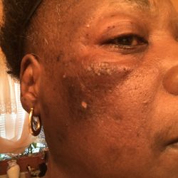 Unique Dermatology