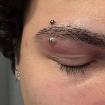 Kissed By A Needle - Infected piercing due to incorrect jewelry - Tattoo Near Me - North Providence, Rhode Island Kissed By A Needle - Infected piercing due to incorrect jewelry - Tattoo Near Me - North Providence, Rhode Island