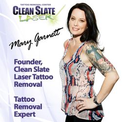 Removery Tattoo Removal & Fading