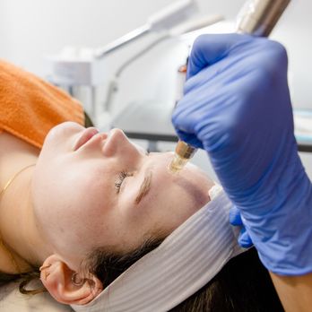 Hello Laser - Microneedling treatments are a great way to target many skin concerns and keep skin youthful and glowing. - Laser Hair Removal Near Me - Tempe, Arizona