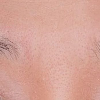 Fuji Cosmetic Ink - Before - Permanent Makeup Near Me - Torrance, California Fuji Cosmetic Ink - Before - Permanent Makeup Near Me - Torrance, California