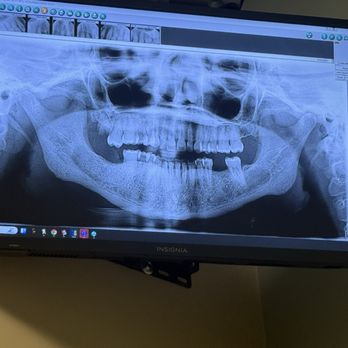 Meadow Ranch Dental Care - My x-ray. I don't want restoration of my teeth because I can't afford it. I just want extraction. - General Dentistry Near Me - Ocala, Florida Meadow Ranch Dental Care - My x-ray. I don't want restoration of my teeth because I can't afford it. I just want extraction. - General Dentistry Near Me - Ocala, Florida