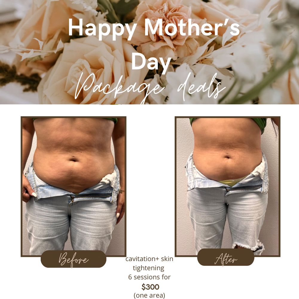 LEX SCULPT BEAUTY BAR San Antonio, Texas Body Contouring Phone Number Yelp