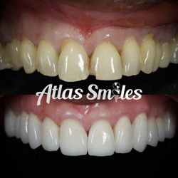 Atlas Smiles