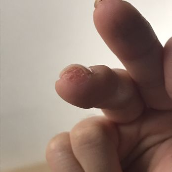 Sugar Nails & Lashes - One week after and still recovering. Cut/burn from sander. - Nail Salons Near Me - Orange, California Sugar Nails & Lashes - One week after and still recovering. Cut/burn from sander. - Nail Salons Near Me - Orange, California