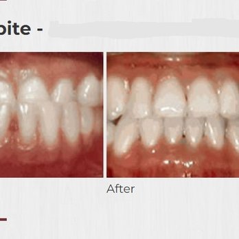 Crossroads Orthodontics - Parker - Orthodontists Near Me - Parker, Colorado Crossroads Orthodontics - Parker - Orthodontists Near Me - Parker, Colorado