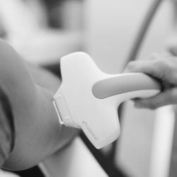Laser Vantage Skin Solutions - Laser Hair Removal