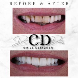Dental Arts by Dr. Cantú Davis - New Smile New life!