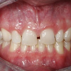 Gregson Family Dentistry: N. Dean Gregson, DMD