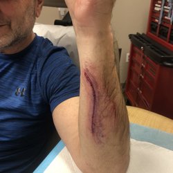 Aspen Medical Center Urgent Care & Primary Care - Gash from hike