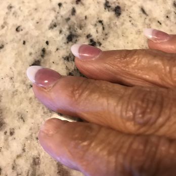 Nail Couture & Pedispa - Missing index fingernail. - Nail Salons Near Me - Myrtle Beach, South Carolina Nail Couture & Pedispa - Missing index fingernail. - Nail Salons Near Me - Myrtle Beach, South Carolina