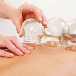Salon West - We do cupping!  Book now!