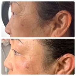 Sculpted Beauty - Ultimate facial