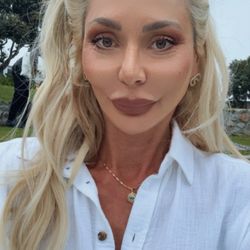 Free & Clear Skin - one week after Pico laser