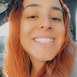 The Bright Spot - Teeth Whitening - After whitening