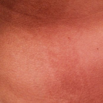 Sugar Cove Belmont Shore 35 Photos 321 Reviews Skin Care