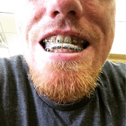 Williams Orthodontics - Adjustments
