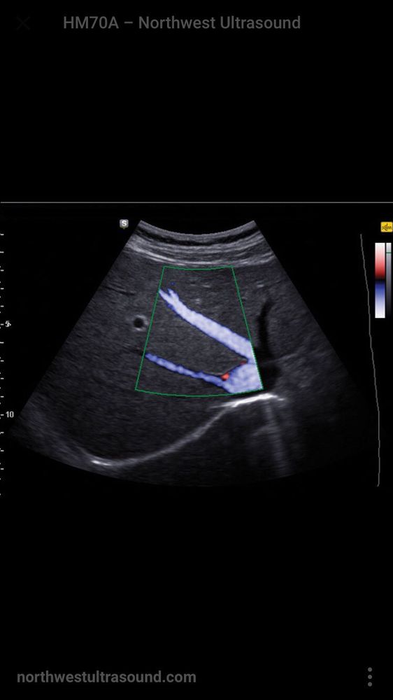ASPRAM AZNAVOUR ULTRASOUND DIAGNOSTICS Updated August 2024 801 S