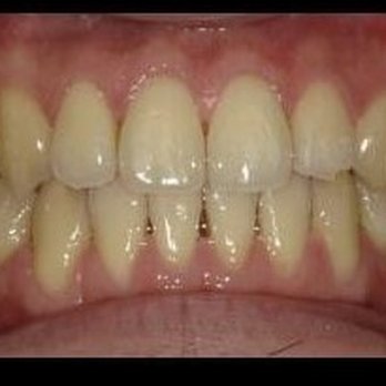 Park 56 Dental - After (May 2020) - General Dentistry Near Me - New York, New York Park 56 Dental - After (May 2020) - General Dentistry Near Me - New York, New York