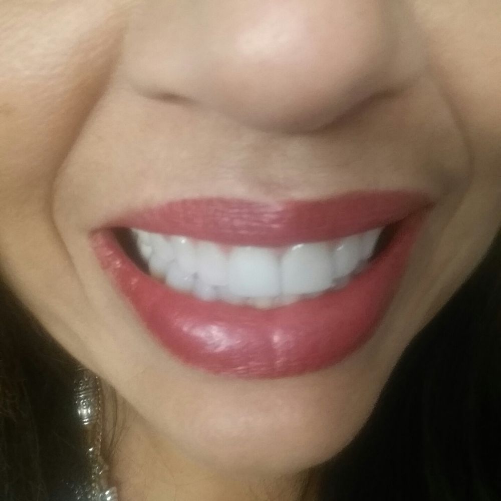 Davie Dental - My perfect smile, thanks to Dr. Sherri Bluth! - Cosmetic Dentists Near Me - Davie, Florida