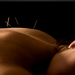 Wynn' Acupuncture