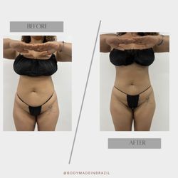 Bodymadeinbrazil - Full package