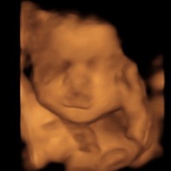 Bond Before Birth 3D/4D Ultrasound - one of my pictures and the features do not look defined or clear.