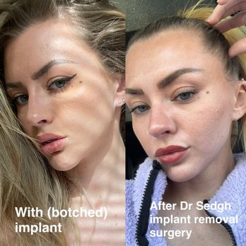 Jacob Sedgh, MD - Cosmetic Surgeons Near Me - West Hollywood, California Jacob Sedgh, MD - Cosmetic Surgeons Near Me - West Hollywood, California