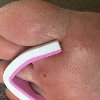 Hannah Nail Spa - Cut open callous and rough skin - Nail Salons Near Me - Las Vegas, Nevada