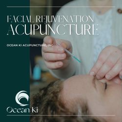 Ocean Ki Acupuncture - Facial Acupuncture