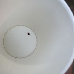 Super 8 by Wyndham Stettler - Bed bug