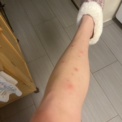 Lavish Nail Care - Infection on the leg caused my pedicure.