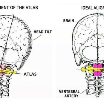 Powers Atlas Solution - Chiropractors Near Me - Fishkill, New York