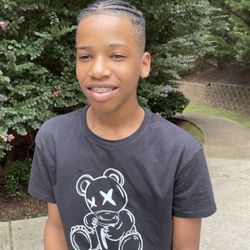 Crawford Orthodontic Care - 2nd treatment. What a difference already.