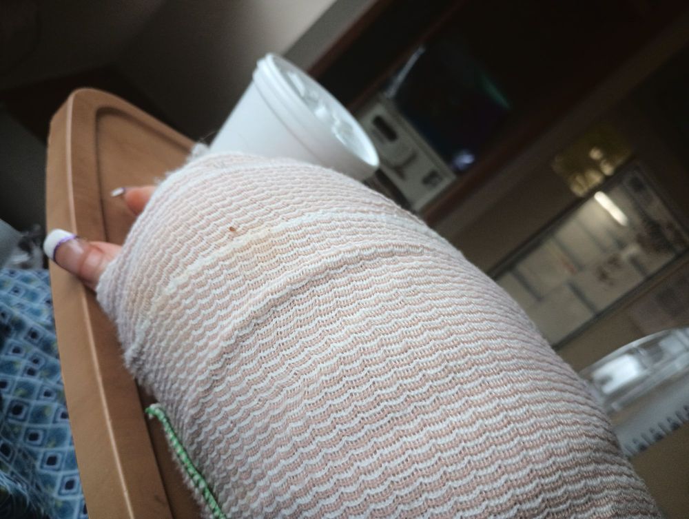 Winters & Yonker Personal Injury Lawyers