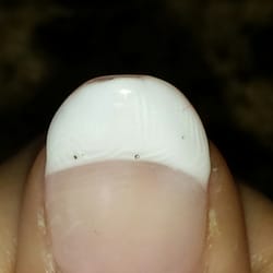 Zealous MediSpa - Photo of the wrinkles and popped bubbles. Cannot see the peeling in this photo.