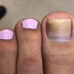 Q-NAILS