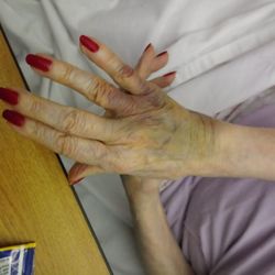 Old Orchard Health Care Center - Signs of Abuse