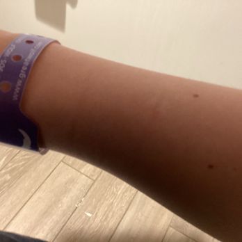 Great Wolf Lodge - Scratch from wristbands - Water Parks Near Me - Perryville, Maryland Great Wolf Lodge - Scratch from wristbands - Water Parks Near Me - Perryville, Maryland