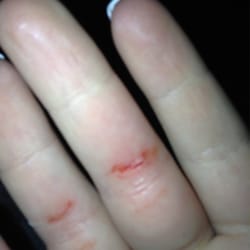 Perfect Nails - Cut after they did my nails. Took forever for the bleed to stop and the pain
