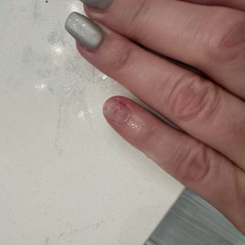 Mimosas Nail Bar - Damaged nail that the tech caused - Nail Salons Near Me - Raleigh, North Carolina Mimosas Nail Bar - Damaged nail that the tech caused - Nail Salons Near Me - Raleigh, North Carolina