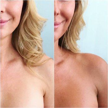 Lavish Tan - Lavish Tan™ before & after showing a customized medium/light color result. - Spray Tanning Near Me - Venice, California Lavish Tan - Lavish Tan™ before & after showing a customized medium/light color result. - Spray Tanning Near Me - Venice, California
