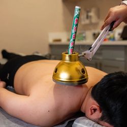 Tensegrity Acupuncture