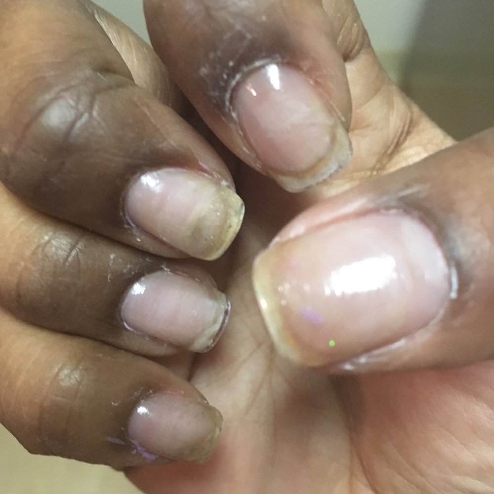 Vy's Nails - Clear top coat over gel after they removed the sloppy nail design and as you can see even the clear top coat was a mess - Nail Salons Near Me - San Leandro, California Vy's Nails - Clear top coat over gel after they removed the sloppy nail design and as you can see even the clear top coat was a mess - Nail Salons Near Me - San Leandro, California