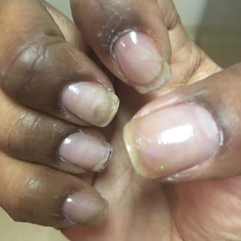 Vy's Nails - Clear top coat over gel after they removed the sloppy nail design and as you can see even the clear top coat was a mess - Nail Salons Near Me - San Leandro, California