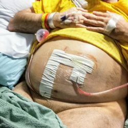 Robert T Rowland MD - UC Health - And the final surgery to complete the reconnect. You really did a damn nice job!!!