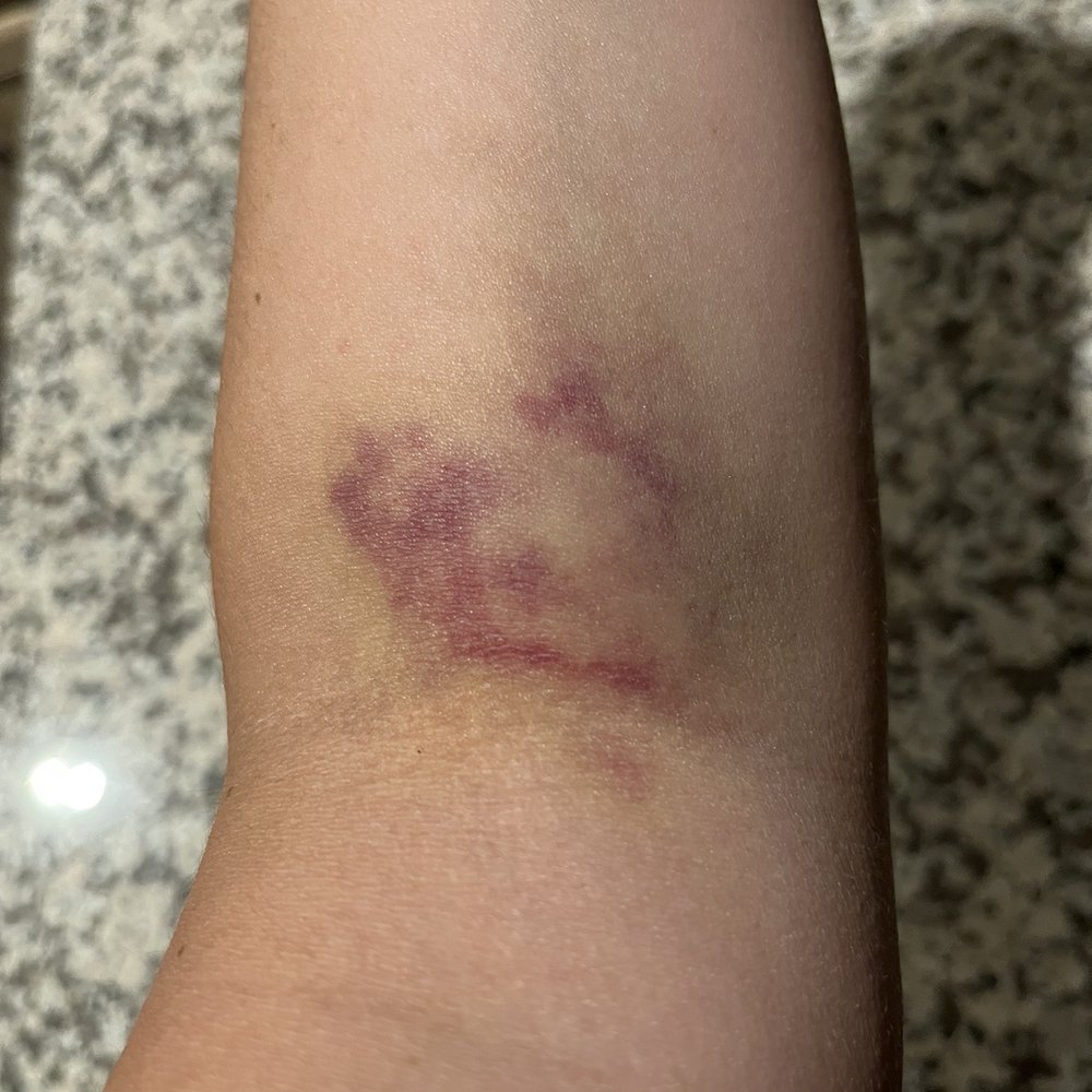 Labcorp - Result of routine blood work - Laboratory Testing Near Me - Phillipsburg, New Jersey Labcorp - Result of routine blood work - Laboratory Testing Near Me - Phillipsburg, New Jersey